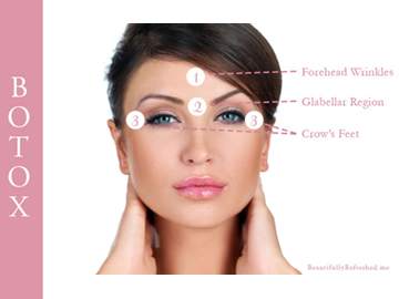 Botox - Flatirons Dermatology