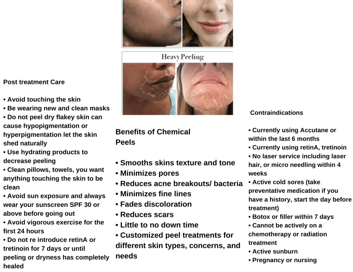 Chemical Peel - Flatirons Dermatology